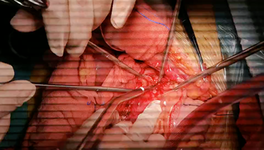 image.png W020210111401667214199.png