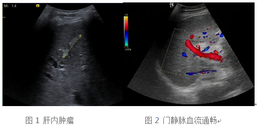 1.png W020210111397694525368.png