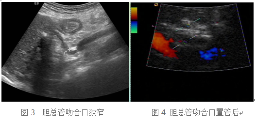 2.png W020210111397694577795.png