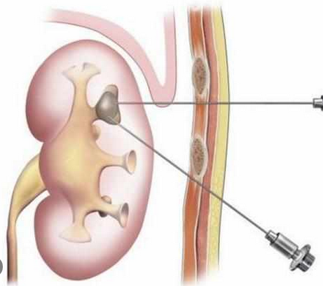 88.png W020210111397685904064.png