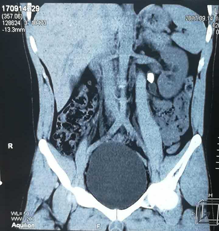 11.jpg W020210111397685994160.jpg