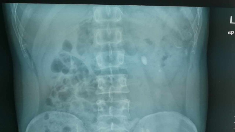 22.jpg W020210111397686032733.jpg