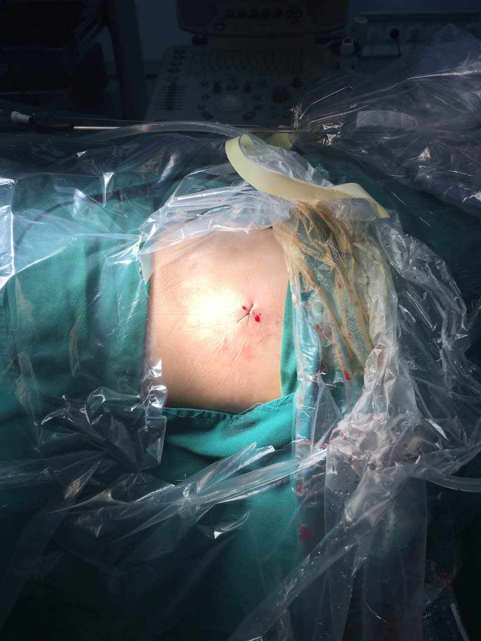 33.jpg W020210111397686073077.jpg