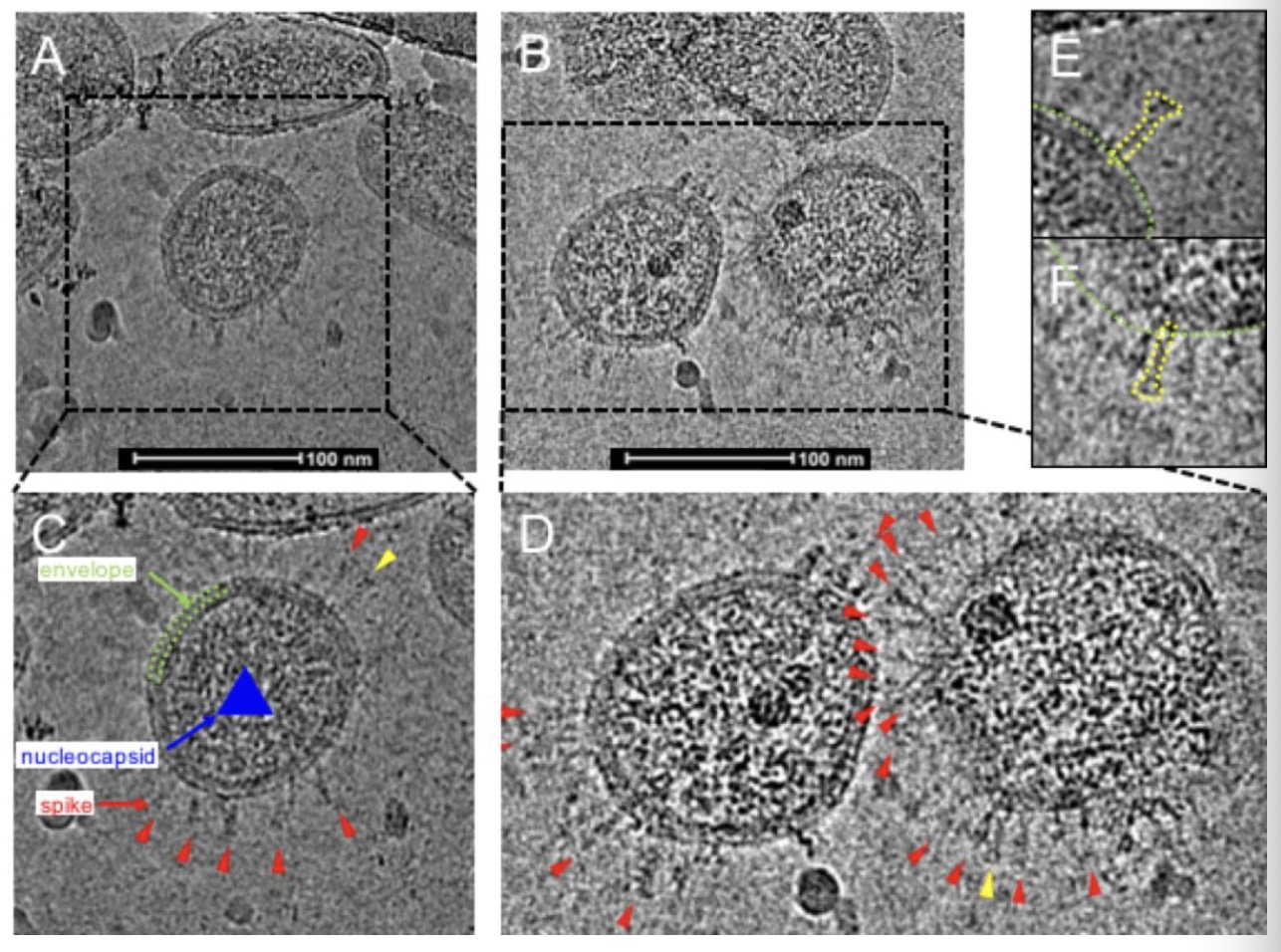 image.png W020210111403218136182.png
